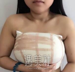 八大处,刘春军,缩胸