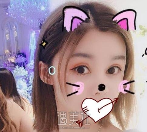 开眼角