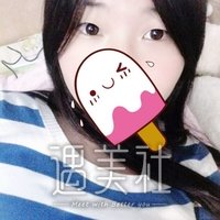 徐学武医生割双眼皮很厉害吗?徐学武双眼皮案例力证哦~