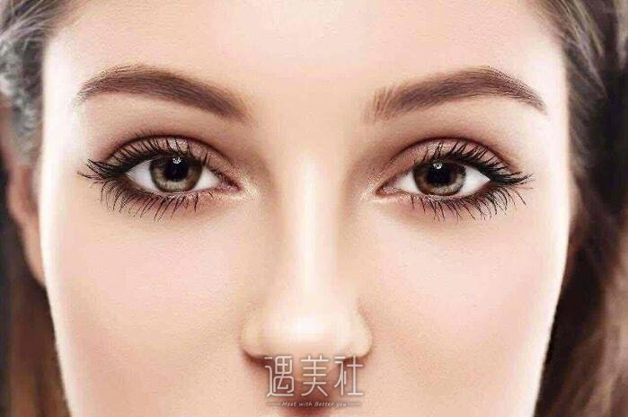什么是微创生态双眼皮呢?生态双眼皮优缺点傲娇大盘点~