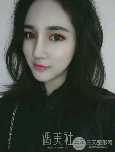 做了鼻头肥大矫正和鼻尖成型，好多男同事来和我搭讪了~