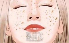 激光祛黄褐斑会有后遗症吗?激光祛黄褐斑后遗症大盘点~“ width=