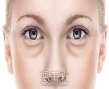 手术调节眼袋的利与弊都有哪些|一起走进手术调节眼袋~ width=