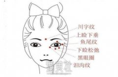 南京除皱价格大约是多少?多种方式有多种收费标准吧? width=