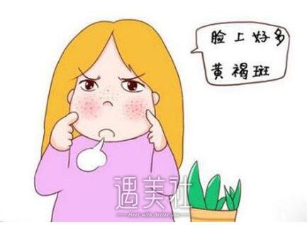 激光祛黄褐斑