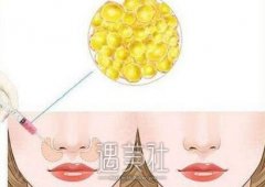 泰安鼻基底脂肪填充术都要多少钱？俺想拯救我的鼻基底~ width=