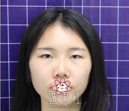 朱占魁,双眼皮