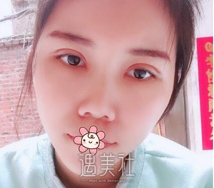朱占魁,双眼皮