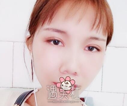 朱占魁,双眼皮