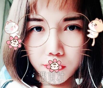 朱占魁,双眼皮