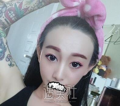 果酸换肤