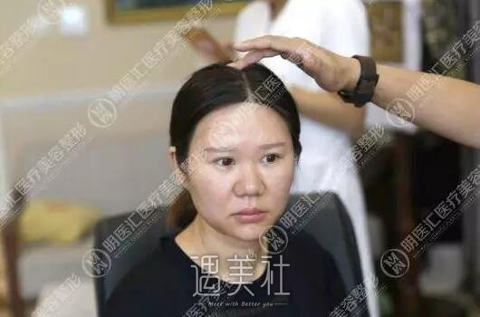 鼻翼大怎么办?鼻翼变小的我有这些话想给大家分享下哦～