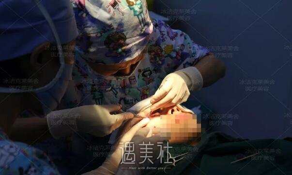 张冰洁医生外眼角修复案例：大小手术都得去正规机构啊～