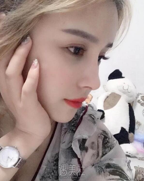 石家庄美联臣做了注射胶原蛋白隆鼻，现在的鼻型很八错～