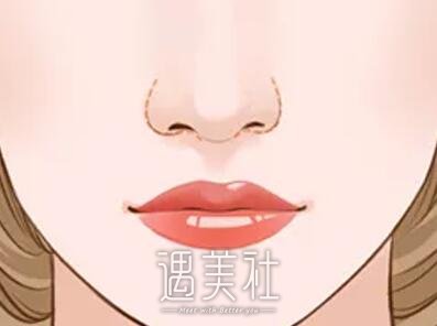 鼻翼大