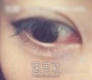 华山,去黑眼圈