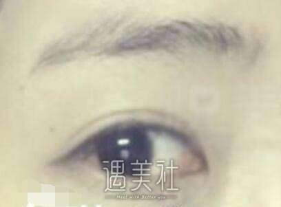 华山,去黑眼圈
