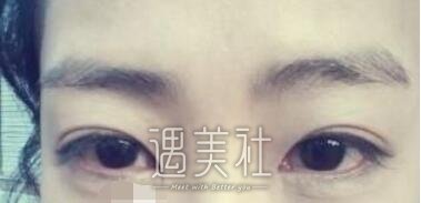 华山,去黑眼圈