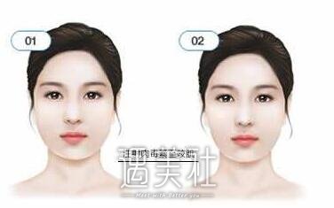 注射瘦脸