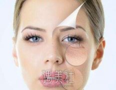 飞梭镭射要做几次果才比较明X?还是只需要做一次就好? width=