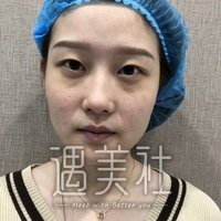 面部光子嫩肤可以除癍吗?脸上太多斑想国庆去做了!