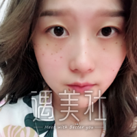 面部光子嫩肤可以除癍吗?脸上太多斑想国庆去做了!