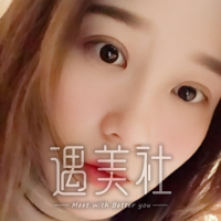 面部光子嫩肤可以除癍吗?脸上太多斑想国庆去做了!
