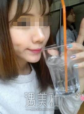 果酸换肤有果吗?刚做果酸换肤不久的我很有发言权~