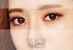 亚韩割双眼皮多少钱，为什么各地的价格都不固定喃? width=