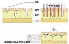 河源做黑脸娃娃的收费标准是怎样的?想做的朋友来看看～ width=