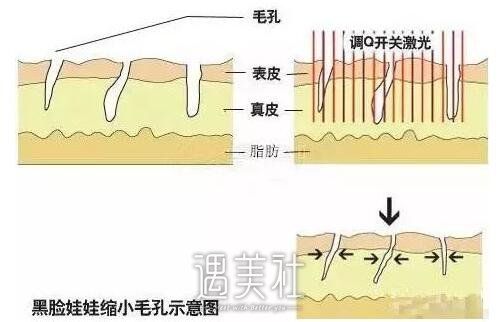黑脸娃娃