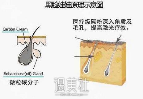 黑脸娃娃