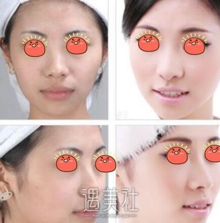 倪彬