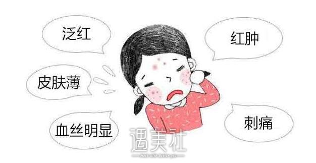 红血丝