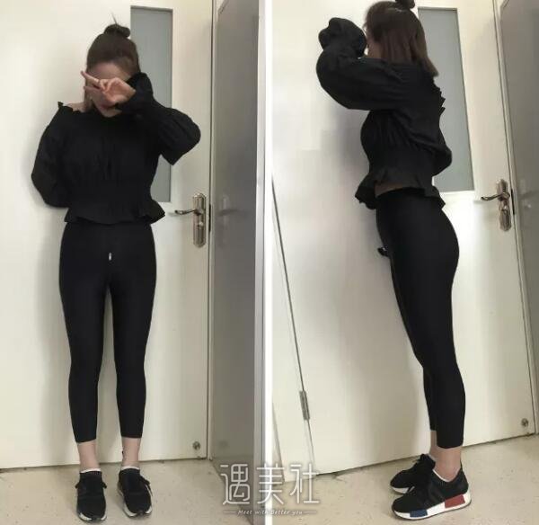 360度环形吸脂果好不好，真实案例分享哦~