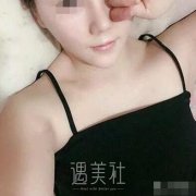 中日友好医院才杰隆胸案例：公立医院的技术就是靠谱! width=