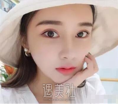 中日友好医院高占巍面部轮廓整形案例，来看看哇～