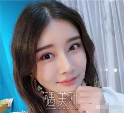 中日友好医院高占巍面部轮廓整形案例，来看看哇～