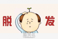 龙岩脱发补发费用多少钱？应该是根据种植面积来定吧？ width=
