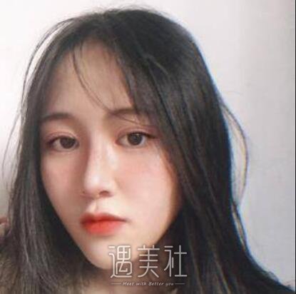 成都,西区,隆鼻