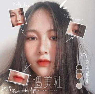 成都,西区,隆鼻