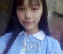 找金敬雅医生做了玻尿酸丰太阳穴，果恢复得炒鸡棒~ width=