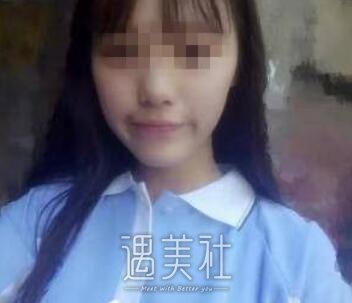 金敬雅,玻尿酸,丰太阳穴