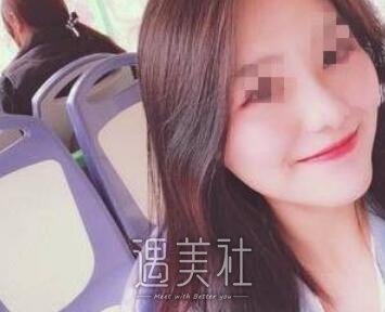 金敬雅,玻尿酸,丰太阳穴