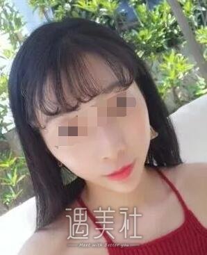 找长春中妍窦颖做了祛雀斑，脸上干干净净的就是好啊~