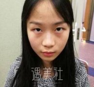 成都玉之光黄光亮医生技术靠谱吗?有近期案例吗? width=