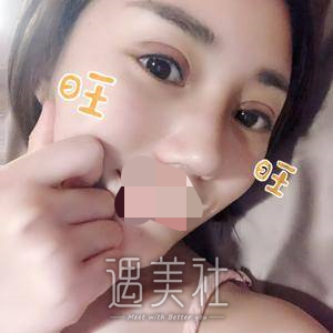 素美帕克