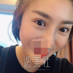 素美帕克