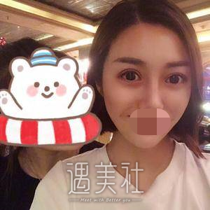 素美帕克