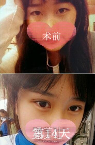 徐永安